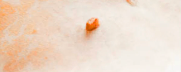 Sudden dog lumps under skin