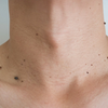 Skin Tag vs HPV: Key Differences, Symptoms, and Treatment