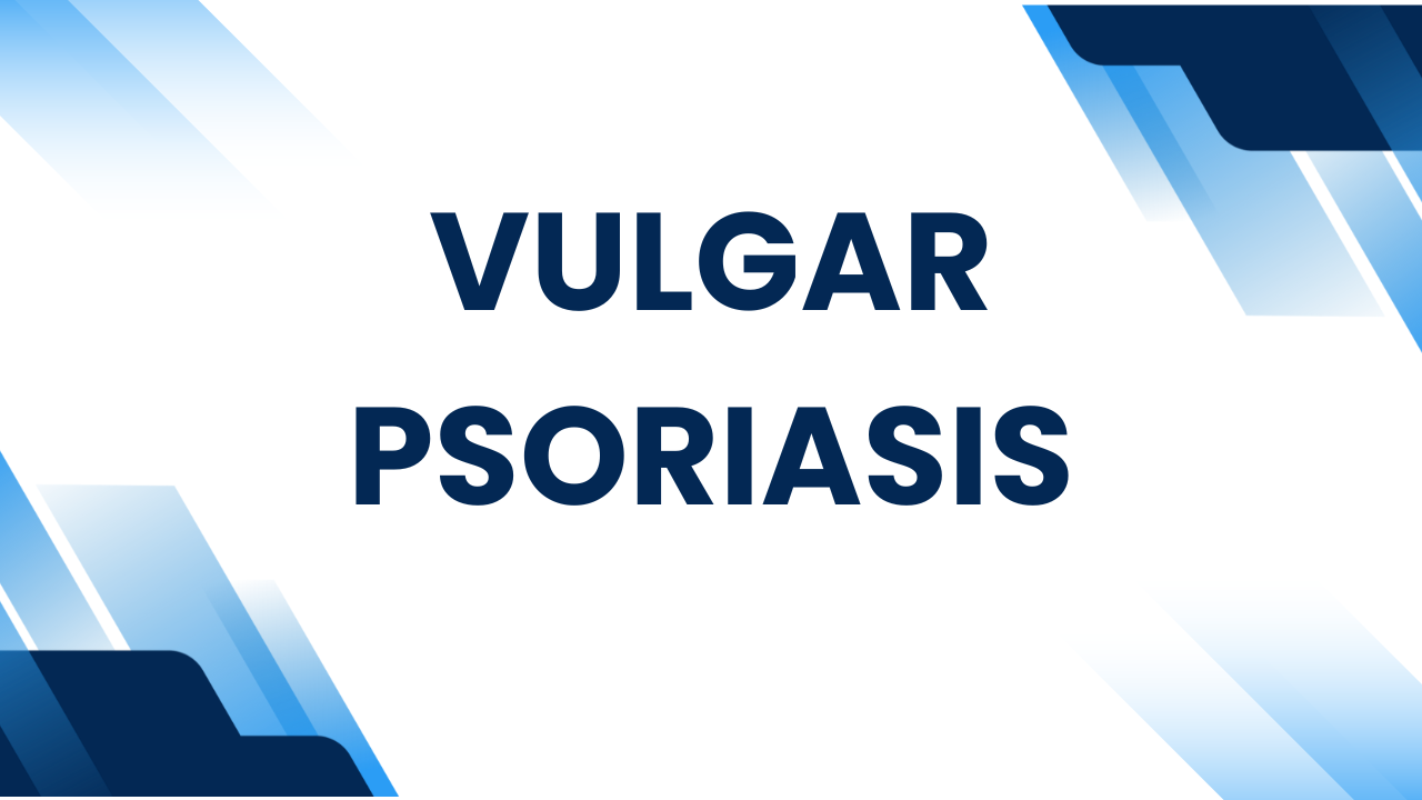 Natural Remedies for Vulgar Psoriasis That Work
