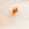 Sudden lumps on Dog under skin: A complete Analysis