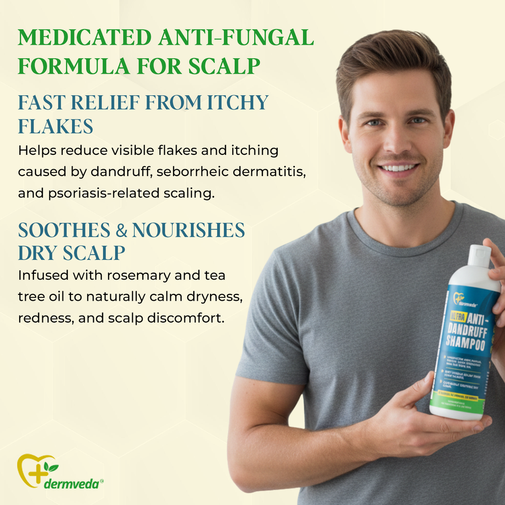 Ultra Anti-Dandruff Shampoo, Medicated Fungus-control Sulphur Formula With Rosemary, and Tea Tree Oil, Relief from Itchy Flakes and Dry Scalp
