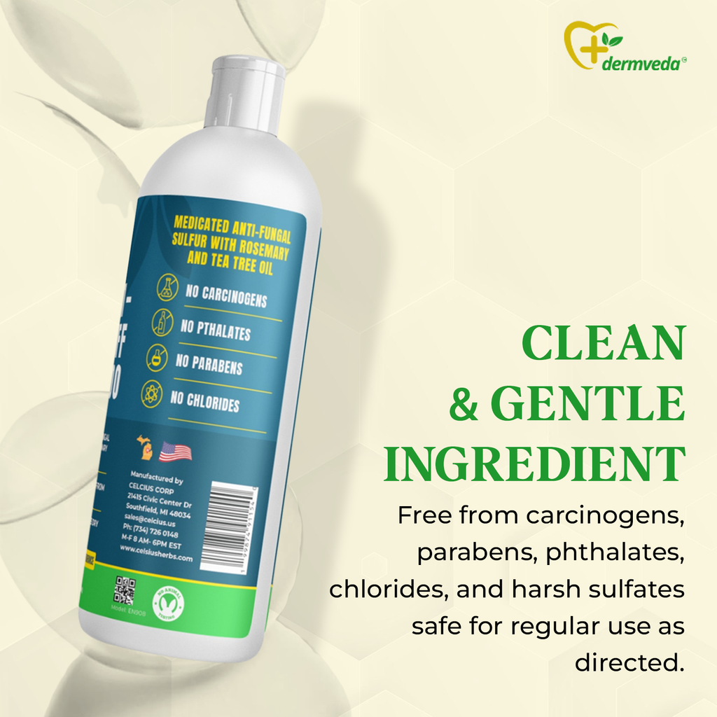 Ultra Anti-Dandruff Shampoo, Medicated Fungus-control Sulphur Formula With Rosemary, and Tea Tree Oil, Relief from Itchy Flakes and Dry Scalp