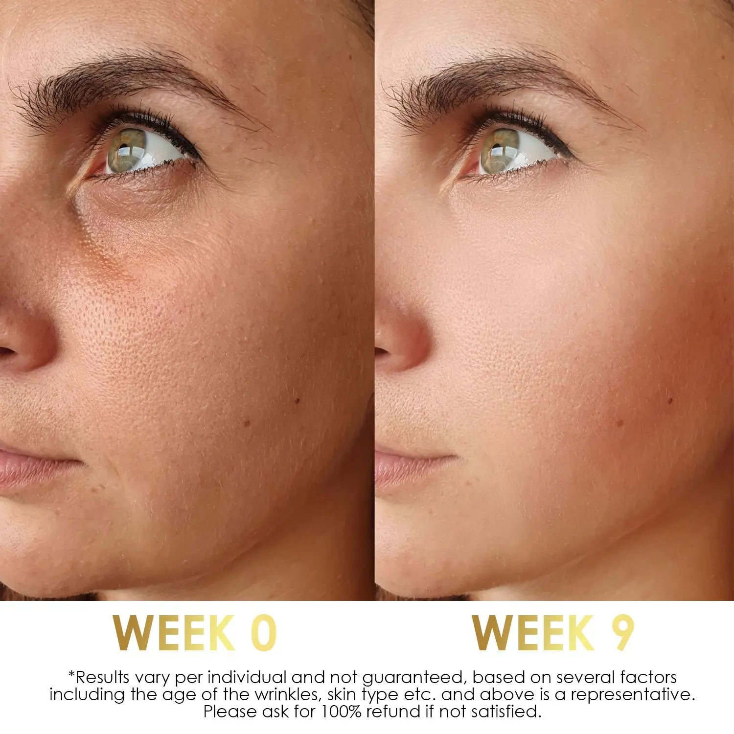 Bakuchiol serum result: skin improvement after 9 weeks of treatment.
