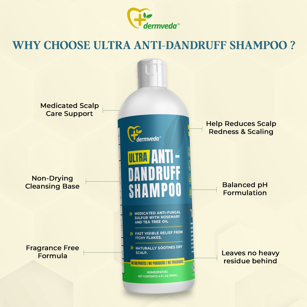 Ultra Anti-Dandruff Shampoo, Medicated Fungus-control Sulphur Formula With Rosemary, and Tea Tree Oil, Relief from Itchy Flakes and Dry Scalp