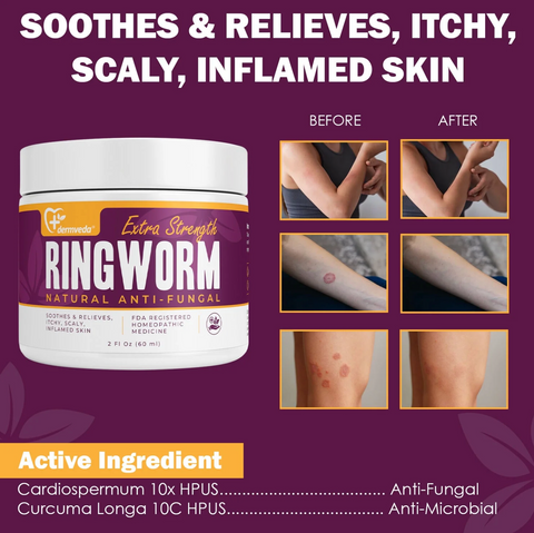 Dermveda Ringworm Treatment for Humans