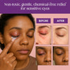 Before and after effects of a product on sensitive eyes with a person applying it.